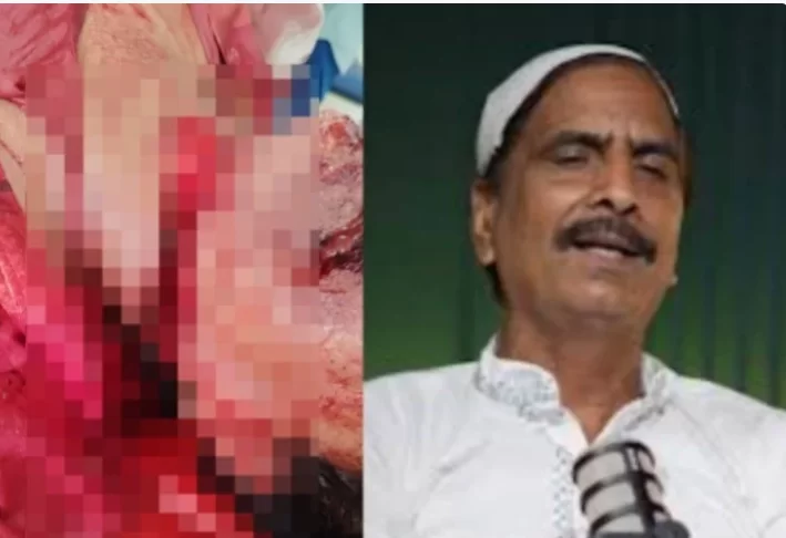 सलीम वास्तिक’ को जुमे के दिन चाकुओं से गोदा!