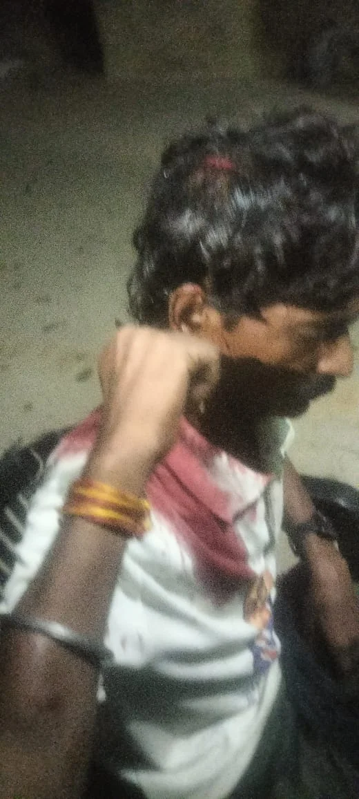 पिपरी थाना क्षेत्र में दबंगों ने पासी समाज के नेता पर लोहे की रॉड से किया हमला, आरोपी फरार