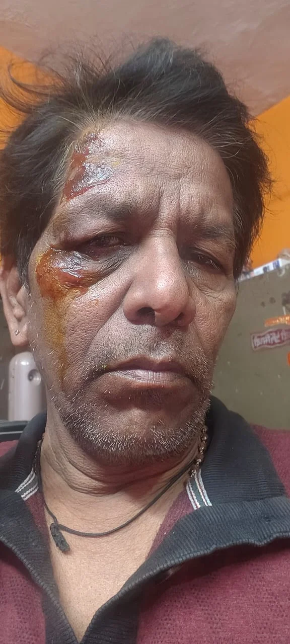 ओवररेट और ओवरटाइम शराब बिक्री का भंडाफोड़ करने पहुंचे पत्रकार से मारपीट, मोबाइल छीना